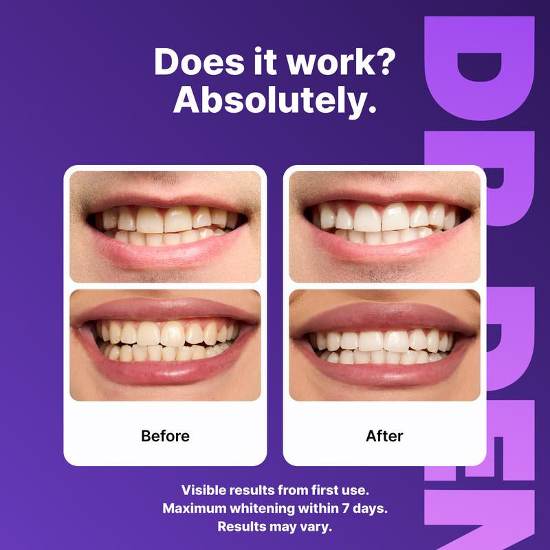 Experience Brilliant Smiles with DR.DENT Purple Teeth Whitening Strips - 7/21 Sessions of Enamel-Safe, Peroxide-Free Whitening for Sensitive Teeth