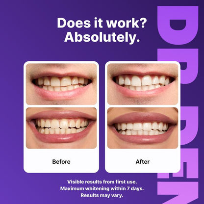Experience Brilliant Smiles with DR.DENT Purple Teeth Whitening Strips - 7/21 Sessions of Enamel-Safe, Peroxide-Free Whitening for Sensitive Teeth